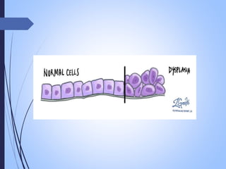 neoplasia , carcinogenesis, tumour market