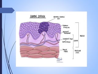 neoplasia , carcinogenesis, tumour market