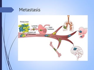 Metastasis
 
