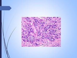 neoplasia , carcinogenesis, tumour market