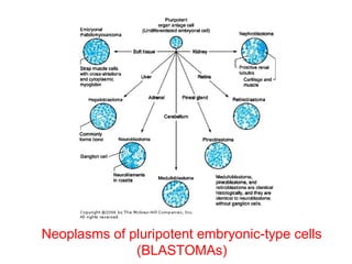Neoplasms of pluripotent embryonic-type cells
(BLASTOMAs)
 