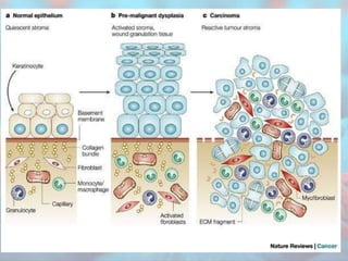 MBBS 2nd Year Pathology - Neoplasia : Introduction | PPTX