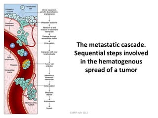 Neoplasia Robbin's path | PPTX