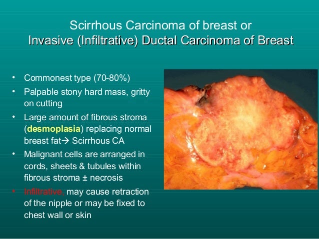 Neoplasia 2