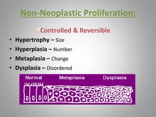 Non-Neoplastic Proliferation:
*Controlled & Reversible
• Hypertrophy – Size
• Hyperplasia – Number
• Metaplasia – Change
• Dysplasia – Disordered
 