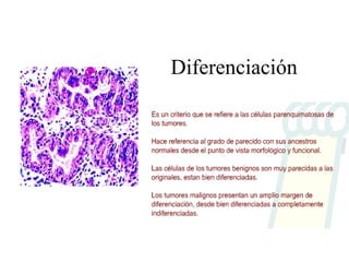 Diferenciación 
 