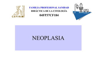 FAMILIA PROFESIONAL SANIDAD 
DIDÁCTICA DE LA CITOLOGÍA 
04FP37CF184 
NEOPLASIA 
 
