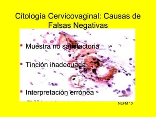  Muestra no satisfactoria
 Tinción inadecuada
 Interpretación errónea
NEFM 10
Citología Cervicovaginal: Causas de
Falsa...