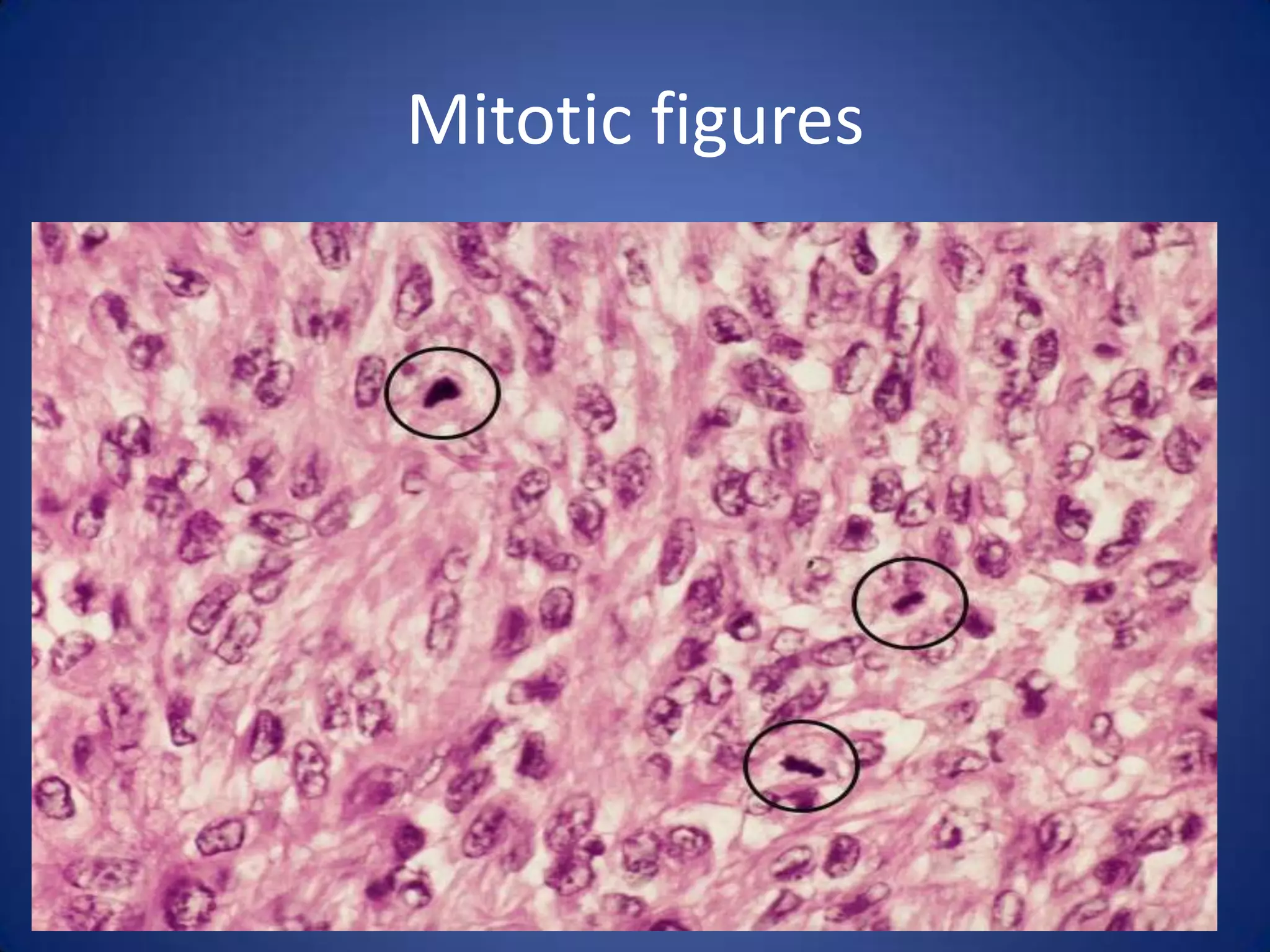 Mitotic figures

 