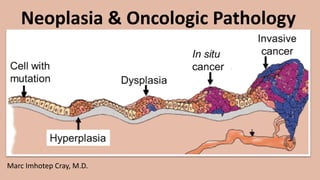 Neoplasia & Oncologic Pathology
Marc Imhotep Cray, M.D.
 