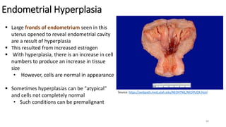 Neoplasia & Oncologic Pathology | PDF