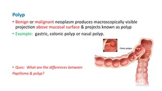Neoplasia [part 1] | PPTX
