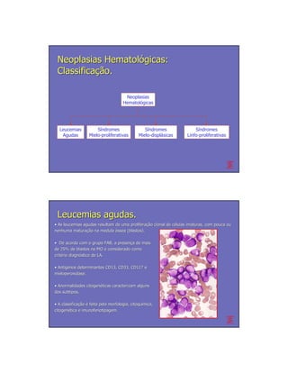 Neoplasias Hematológicas:
 Classificação.

                                       Neoplasias
                                      Hematológicas




  Leucemias            Síndromes                  Síndromes             Síndromes
   Agudas          Mielo-proliferativas        Mielo-displásicas    Linfo-proliferativas




 Leucemias agudas.
• As leucemias agudas resultam de uma proliferação clonal de células imaturas, com pouca ou
                                      proliferação           cé
nenhuma maturação na medula óssea (blastos).
          maturação

• De acordo com o grupo FAB, a presença de mais
                               presenç
de 25% de blastos na MO é considerado como
critério diagnóstico de LA.
crité diagnó

• Antígenos determinantes CD13, CD33, CD117 e
  Antí
mieloperoxidase.

• Anormalidades citogenéticas caracterizam alguns
                citogené
dos subtipos.

• A classificação é feita pela morfologia, citoquímica,
    classificação                          citoquí
citogenética e imunofenotipagem.
citogené
 