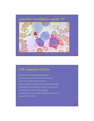 Leucemia mieloblástica aguda. M7




                                                           CD 41




LMA: Aspectos Clínicos
• Cansaço na quase totalidade dos pacientes.
  Cansaç
• Dor óssea ou articular em até 20% dos pacientes
                            até
• Febre sem infecção em 20% dos casos
            infecção
• Mais da metade dos pacientes apresentam perda de peso.
• Manifestações hemorrágicas em mais de 50% dos casos.
  Manifestações hemorrá
• A infecção é uma intercorrência freqüente
    infecção       intercorrê     freqü
• A sobrevida é de cerca de 50% independente da forma de
tratamento, QT ou TMO.
 