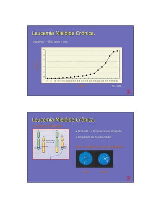 Leucemia Mielóide Crônica.
Incidência – 4500 casos / ano.
Incidê
  Incidência
  Incidê




                                   Idade                        NCI, 2006.




Leucemia Mielóide Crônica.
Cromossomo Philadelphia

                                 • BCR-ABL → Tirosino-cinase alongada.
                                   BCR-      Tirosino-

                                 • Regulação da divisão celular.
                                   Regulação    divisã


                                 FISH – Fluorescence in situ hybridization.




                                      Normal         Anormal
 