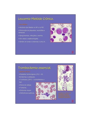 Leucemia Mielóide Crônica.
Crise blástica
      blá

• Aumento dos blastos no SP e na MO.

• Diminuição de plaquetas, neutrófilos e
  Diminuição               neutró
hemácias.
hemá

• Sangramentos, infecções e anemia.
                infecções

• Dor óssea e esplenomegalia.

• Similar em sinais e sintomas a uma LA.




Trombocitemia essencial.
Aspectos clínicos
         clí
• Episódios hemorrágicos (4%) – GI,
  Episó     hemorrá
hematomas e petéquias.
            peté
• Tromboses (20%) – tromboflebites e
TVP.
• Dores de cabeça.
           cabeç
• Tonteiras.
• Sintomas visuais.
• Deficiências auditivas.
  Deficiê                                  Aumento do número de
                                                        nú
                                           plaquetas, presença
                                                      presenç
                                           de plaquetas grandes e
                                           agregados plaquetários.
                                                      plaquetá
 