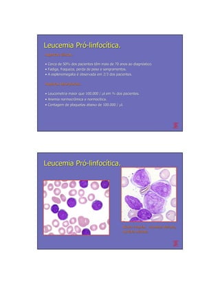 Leucemia Pró-linfocítica.
Aspectos clínicos.
         clí

• Cerca de 50% dos pacientes têm mais de 70 anos ao diagnóstico.
                              tê                     diagnó
• Fadiga, fraqueza, perda de peso e sangramentos.
• A esplenomegalia é observada em 2/3 dos pacientes.

Aspectos laboratoriais.

• Leucometria maior que 100.000 / µl em ¾ dos pacientes.
• Anemia normocrômica e normocítica.
         normocrô       normocí
• Contagem de plaquetas abaixo de 100.000 / µl.




Leucemia Pró-linfocítica.




                                              Núcleo irregular, cromatina delicada,
                                              nucléolo evidente.
                                              nuclé
 