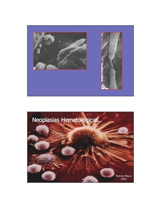 Neoplasias Hematológicas.




                            Marcos Fleury
                                UFRJ
 