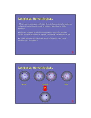 Neoplasias Hematológicas.
• São doenças causadas pela proliferação descontrolada de células hematológicas
      doenç                 proliferação                  cé      hematoló
malignas ou incapacidade da medula de produzir a quantidade de células
                                                                 cé
adequada.

• Podem ser estudadas através da microscopia ótica, colorações especiais,
                       atravé                         colorações
reações imunológicas (citometria), técnicas citogenéticas (cariotipagem), e PCR.
reações imunoló                    té       citogené

• A medula óssea é a principal afetada nestas enfermidades e seu exame é
necessário para o diagnóstico.
necessá           diagnó




Neoplasias Hematológicas.




     Normal                         Neoplasia                         Óbito

                                       QT
 