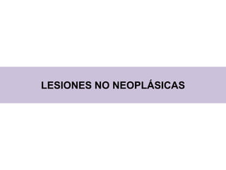 LESIONES NO NEOPLÁSICAS
 