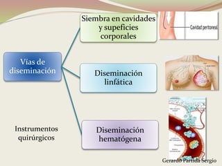 Vías de
diseminación
Siembra en cavidades
y supeficies
corporales
Diseminación
linfática
Diseminación
hematógena
Instrumentos
quirúrgicos
Gerardo Partida Sergio
 