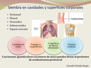 Siembra en cavidades y superficies corporales
 Peritoneal
 Pleural
 Pericárdica
 Subaracnoidea
 Espacio articular
Carcinoma de
ovario
Propaga vía
trasperitoneal
A superficies
de visceras
abdominales
*Invasión
profunda
Carcinomas apendiculares secretores de moco pueden llenar el peritoneo
de seudomixoma peritoneal
Gerardo Partida Sergio
 