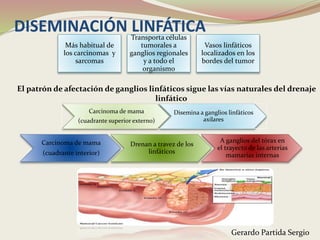DISEMINACIÓN LINFÁTICA
El patrón de afectación de ganglios linfáticos sigue las vías naturales del drenaje
linfático
Carcinoma de mama
(cuadrante superior externo)
Disemina a ganglios linfáticos
axilares
Carcinoma de mama
(cuadrante interior)
Drenan a travez de los
linfáticos
A ganglios del tórax en
el trayecto de las arterias
mamarias internas
Más habitual de
los carcinomas y
sarcomas
Transporta células
tumorales a
ganglios regionales
y a todo el
organismo
Vasos linfáticos
localizados en los
bordes del tumor
Gerardo Partida Sergio
 