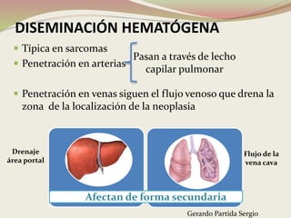 DISEMINACIÓN HEMATÓGENA
 Típica en sarcomas
 Penetración en arterias
 Penetración en venas siguen el flujo venoso que drena la
zona de la localización de la neoplasia
Pasan a través de lecho
capilar pulmonar
Afectan de forma secundaria
Drenaje
área portal
Flujo de la
vena cava
Gerardo Partida Sergio
 