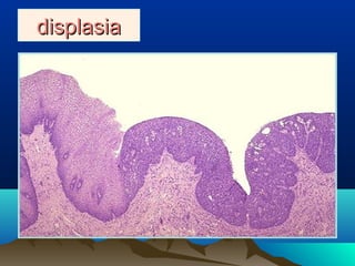 displasiadisplasia
 