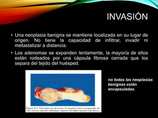 INVASIÓN
• Una neoplasia benigna se mantiene localizada en su lugar de
origen. No tiene la capacidad de infiltrar, invadir ni
metastatizar a distancia.
• Los adenomas se expanden lentamente, la mayoría de ellos
están rodeados por una cápsula fibrosa cerrada que los
separa del tejido del huésped.
no todas las neoplasias
benignas están
encapsuladas.
 