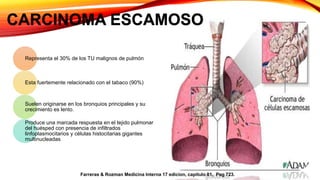Representa el 30% de los TU malignos de pulmón
Esta fuertemente relacionado con el tabaco (90%)
Suelen originarse en los bronquios principales y su
crecimiento es lento.
Produce una marcada respuesta en el tejido pulmonar
del huésped con presencia de infiltrados
linfoplasmocitarios y células histocitarias gigantes
multinucleadas
CARCINOMA ESCAMOSO
Farreras & Rozman Medicina Interna 17 edicion, capitulo 81, Pag 723.
 