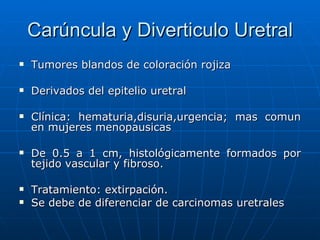 Carúncula y Diverticulo Uretral <ul><li>Tumores blandos de coloración rojiza </li></ul><ul><li>Derivados del epitelio uret...