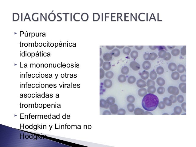 Neoplasias hematopoyeticas