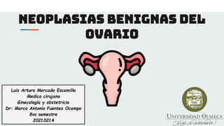 Neoplasias benignas del
ovario
Luis Arturo Mercado Escamilla
Medico cirujano
Ginecología y obstetricia
Dr: Marco Antonio Fuentes Ocampo
8vo semestre
20210214
 