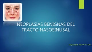 NEOPLASIAS BENIGNAS DEL
TRACTO NASOSINUSAL
JAQUELINE NIEVA R 3 ORL
 