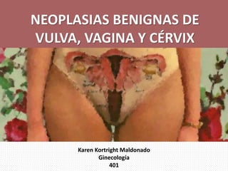 NEOPLASIAS BENIGNAS DE
VULVA, VAGINA Y CÉRVIX
Karen Kortright Maldonado
Ginecología
401
 