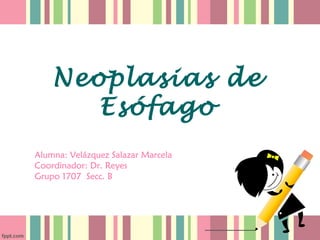Neoplasias de
       Esófago
Alumna: Velázquez Salazar Marcela
Coordinador: Dr. Reyes
Grupo 1707 Secc. B
 