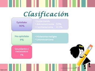 Clasificación
 