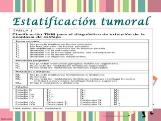 Estatificación tumoral
 