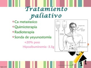 Tratamiento
      paliativo
Ca metastasico
Quimioterapia
Radioterapia
Sonda de yeyunostomía
     +20% peso
    Hipoalbuminemia -3.5g
 