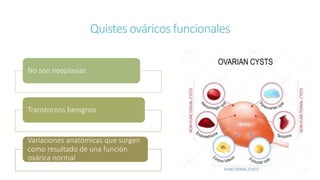 Quistes ováricos funcionales
No son neoplasias
Transtornos benignos
Variaciones anatómicas que surgen
como resultado de una función
ovárica normal
 