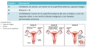 Estadio I Descripción
IA Unilateral, sin ascitis, sin tumor en la superficie externa, capsula integra
IB Bilateral + IA
IC Uni/bilateral, tumor en la superficie externa de uno o ambos, o con las
capsulas rotas, o con ascitis (células malignas) o con lavados
peritoneales positivos
Características :
• Cápsula íntegra
• Ascitis
• Tumor en la superficie
 