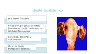 Quiste tecaluteínico
Es el menos frecuente
Recubiertos por células de la teca
(luteinizadas o no) y contienen o no
células de la granulosa
Bilaterales, pequeños y
multiquísticos.
Llenos de líquido
transparente color paja
 
