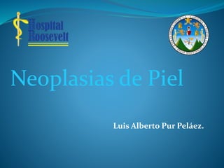 Luis Alberto Pur Peláez.
Neoplasias de Piel
 