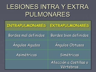 LLEESSIIOONNEESS IINNTTRRAA YY EEXXTTRRAA 
PPUULLMMOONNAARREESS 
 