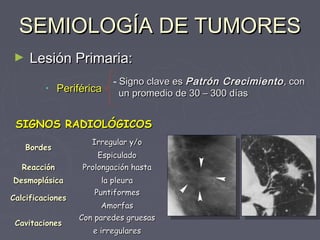 SSEEMMIIOOLLOOGGÍÍAA DDEE TTUUMMOORREESS 
► LLeessiióónn PPrriimmaarriiaa:: 
• PPeerriifféérriiccaa - SSiiggnnoo ccllaavvee eess PPaattrróónn CCrreecciimmiieennttoo,, ccoonn 
uunn pprroommeeddiioo ddee 3300 –– 330000 ddííaass 
SSIIGGNNOOSS RRAADDIIOOLLÓÓGGIICCOOSS 
BBoorrddeess Irregular y/o 
EEssppiiccuullaaddoo 
RReeaacccciióónn 
DDeessmmoopplláássiiccaa 
PPrroolloonnggaacciióónn hhaassttaa 
llaa pplleeuurraa 
CCaallcciiffiiccaacciioonneess Puntiformes 
AAmmoorrffaass 
CCaavviittaacciioonneess Con paredes gruesas 
ee iirrrreegguullaarreess 
 