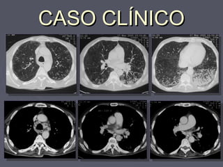 CCAASSOO CCLLÍÍNNIICCOO 
 