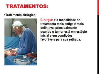 TRATAMENTOS:
.
 