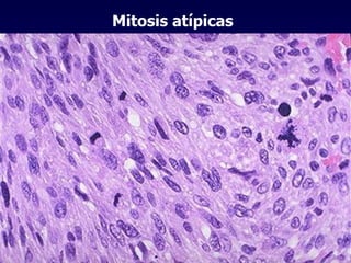 Mitosis atípicas 