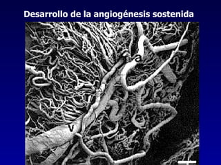 Desarrollo de la angiogénesis sostenida   